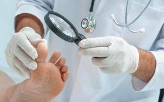 Грибок ногтей на ногах: выявляем и лечим правильно