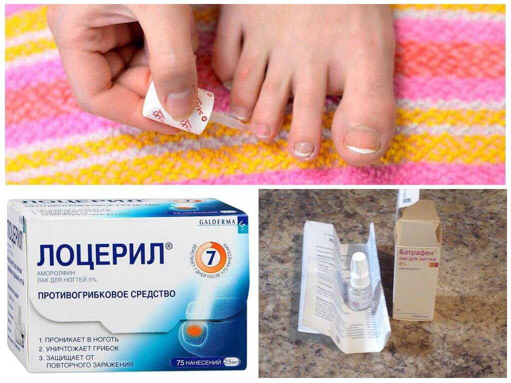Эффективные и недорогие таблетки от грибка ногтей