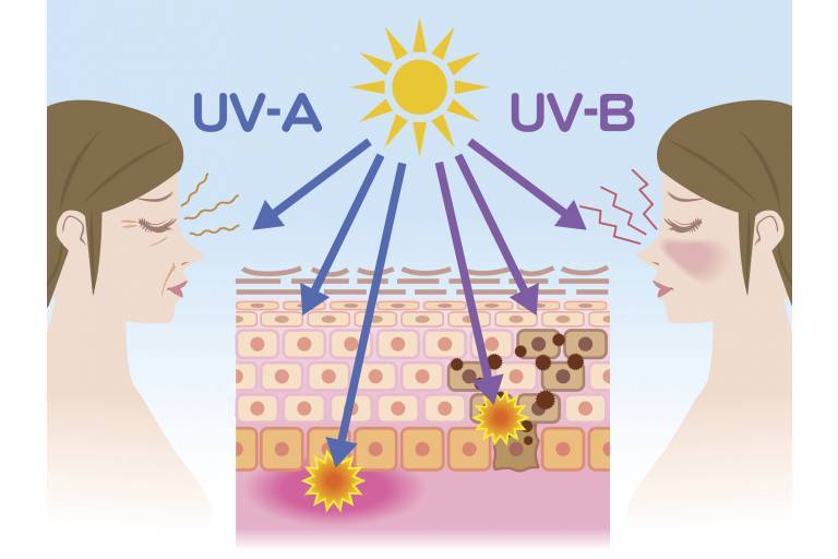 Вред солнца для вашей кожи : здоровье