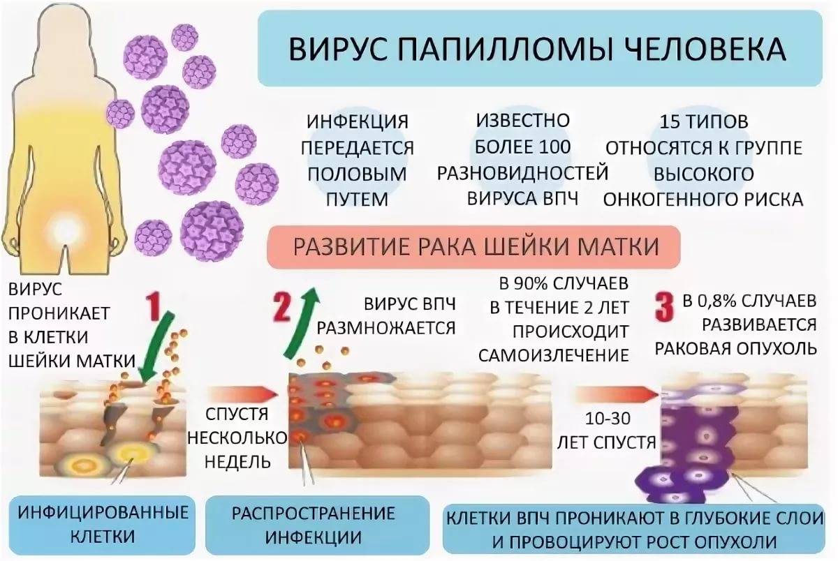 Морфологическая картина плоскоклеточной папилломы в желудке - wikimediconline.ru