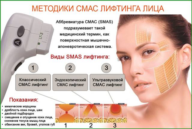 Фотоомоложение кожи лица: плюсы и минусы, эффект и уход после лазерной процедуры