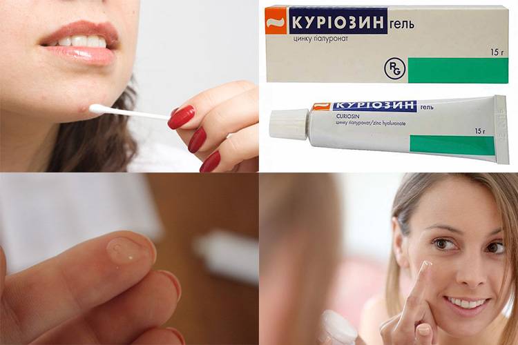 «куриозин»: особенности применения и аналоги препарата - cosmetism
