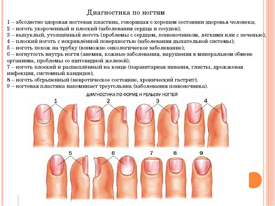 Диагностика по ногтям пальцев рук с фото - по форме, цвету и лунке