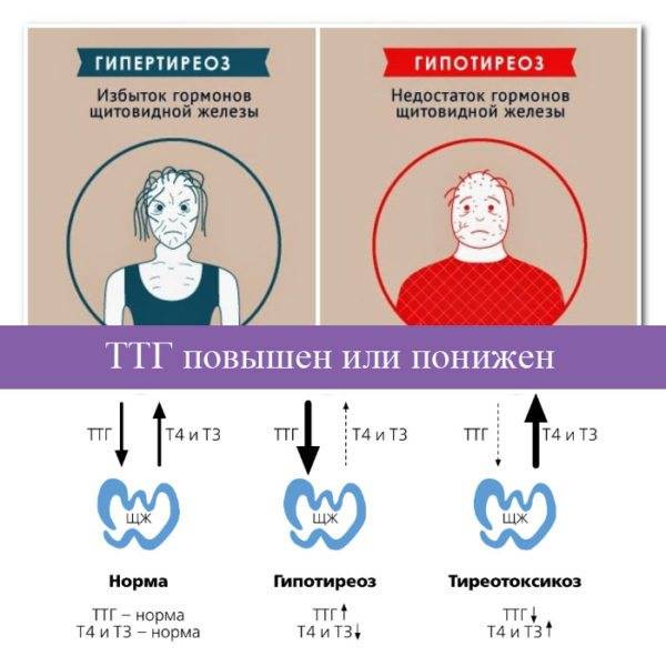Диета При Тиреотоксикозе Щитовидной Железы У Женщин
