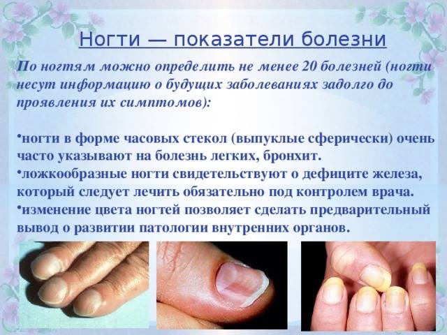 Почему появляются продольные полосы на ногтях рук: причины, способы лечения и профилактические меры