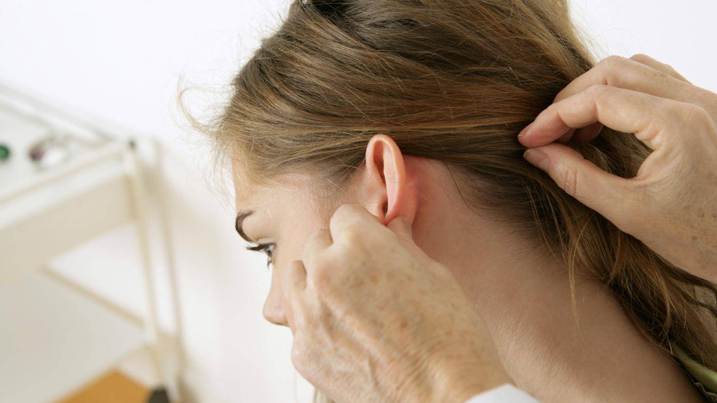 Псориаз в ухе: симптомы, причины, лечение ушной раковины, а также фото псориаза за ушами