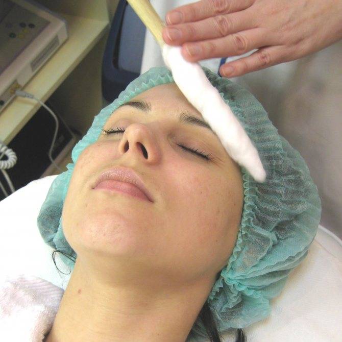 Криотерапия кожи лица и волосистой части головы