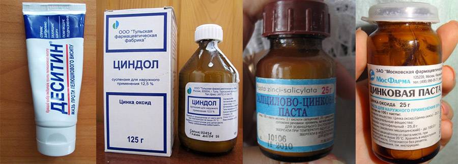 Мази от псориаза на коже: эффективные и недорогие препараты (список, отзывы, цены)