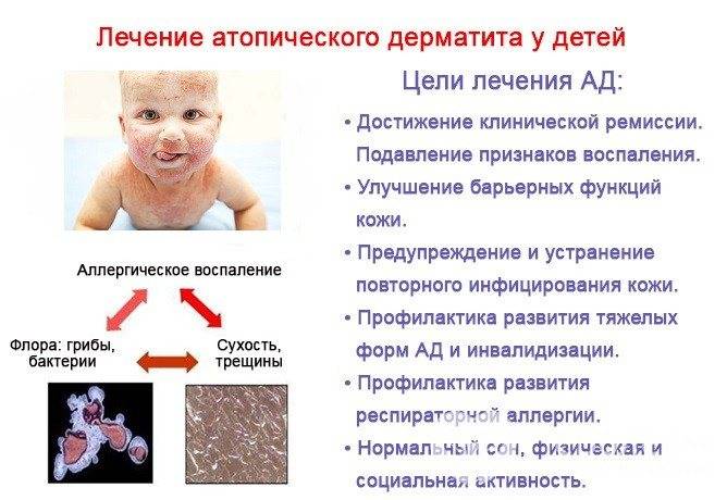 Перианальный дерматит у ребенка причины