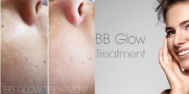 Bb glow treatment: правда о «тональном креме на год»