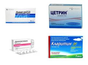 Эффективные таблетки от экземы на руках, список лучших препаратов для лечения дерматита
