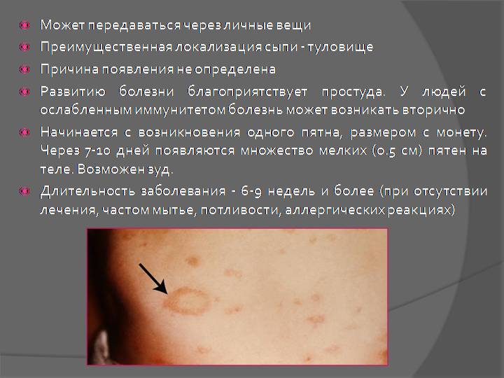 Опоясывающий лишай — фото, признаки, лечение | заболевания кожи