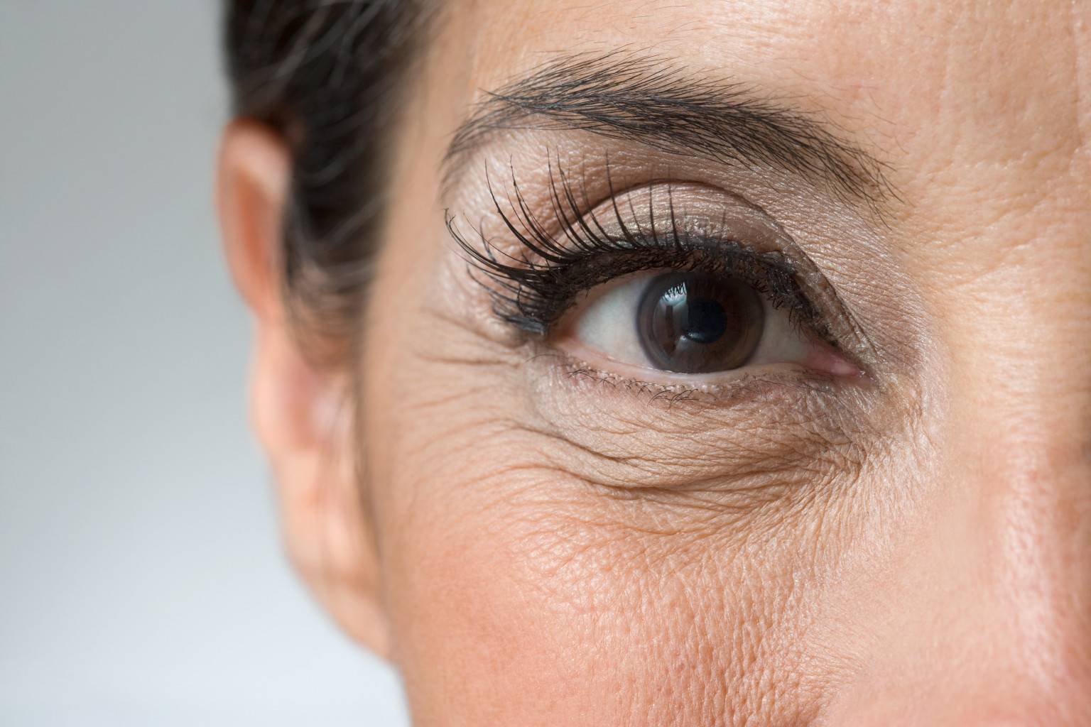 Как убрать морщины под глазами и вокруг глаз?