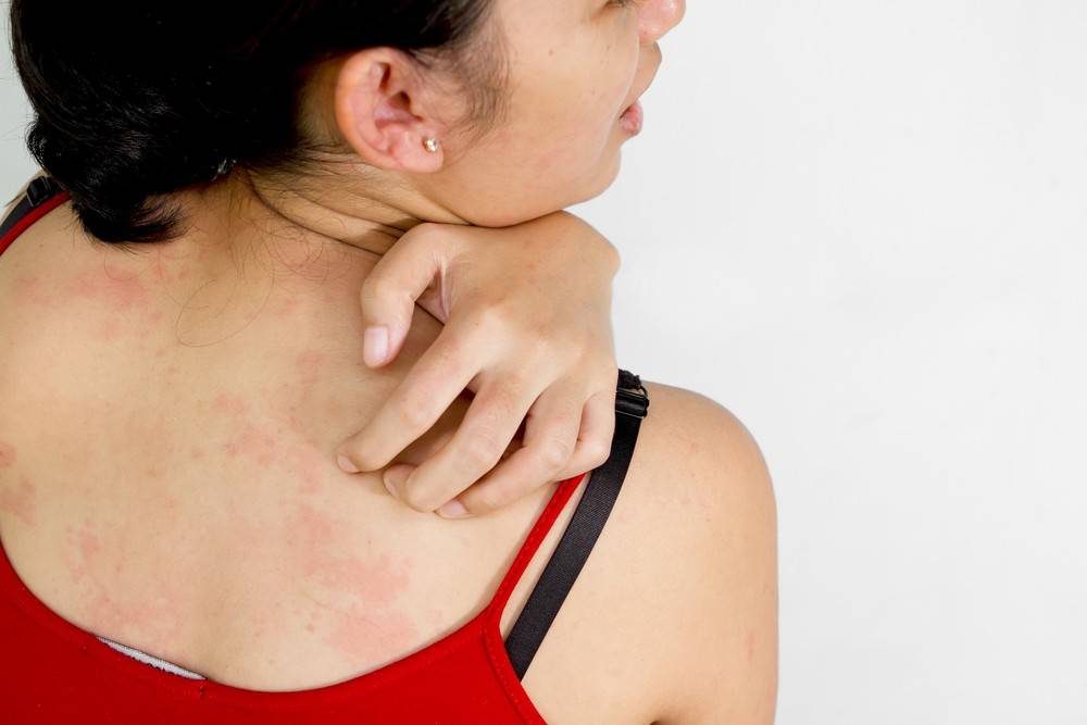 Причины появления зудящего дерматита
