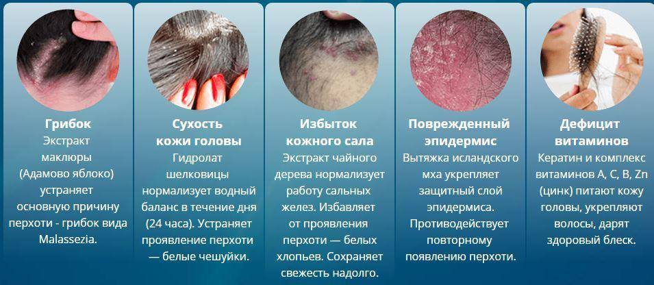 Дерматит кожи: фото, симптомы, причины, виды, лечение