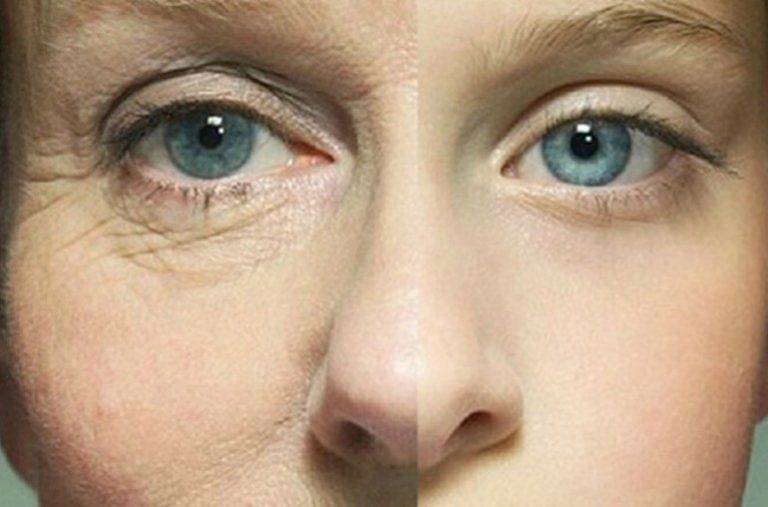 Народные средства от морщин вокруг глаз: все лучшие и эффективные способы (+ рецепты) | нет морщин