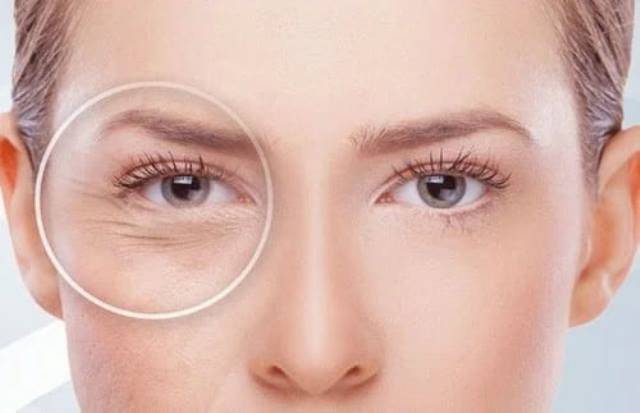 Народные средства от морщин вокруг глаз: все лучшие и эффективные способы (+ рецепты)
