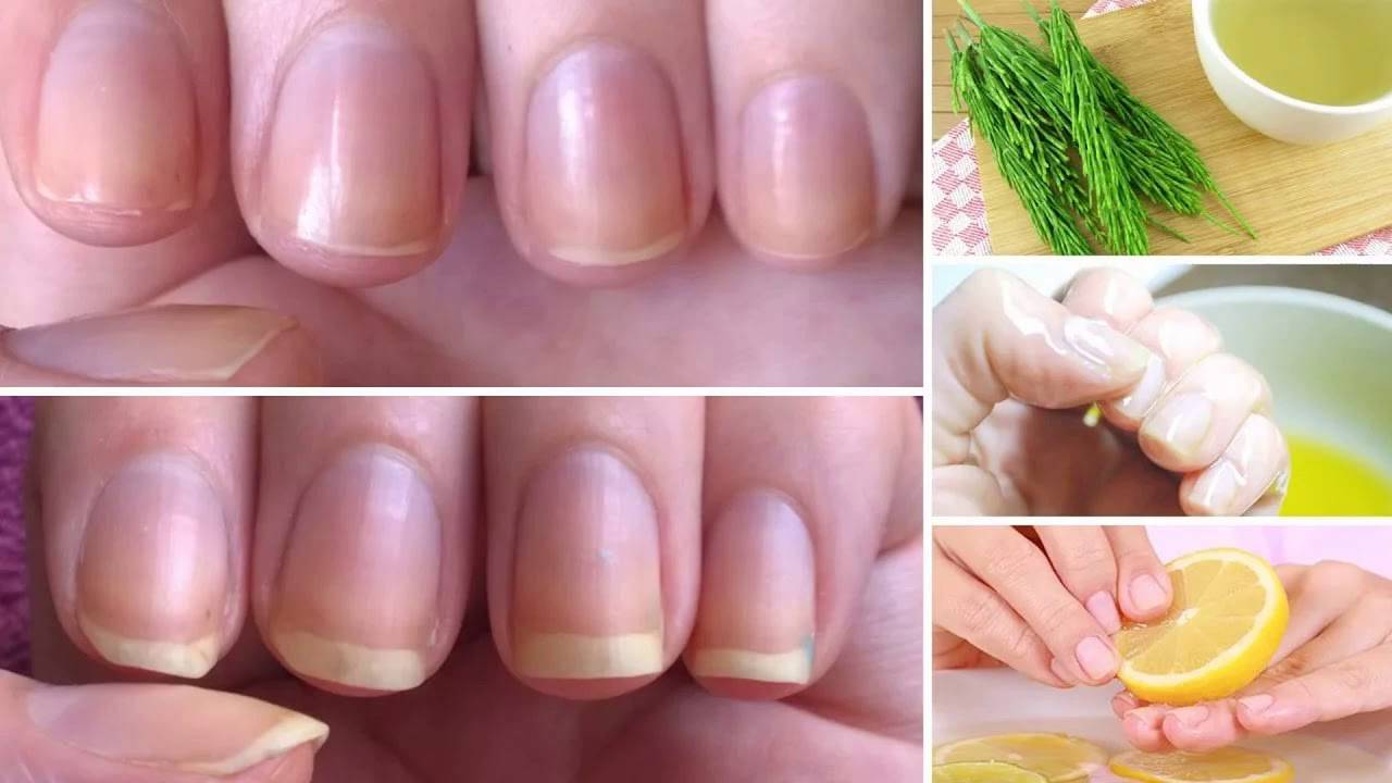 Лучшие средства для восстановление ногтей после шеллака, гель-лака и наращивания