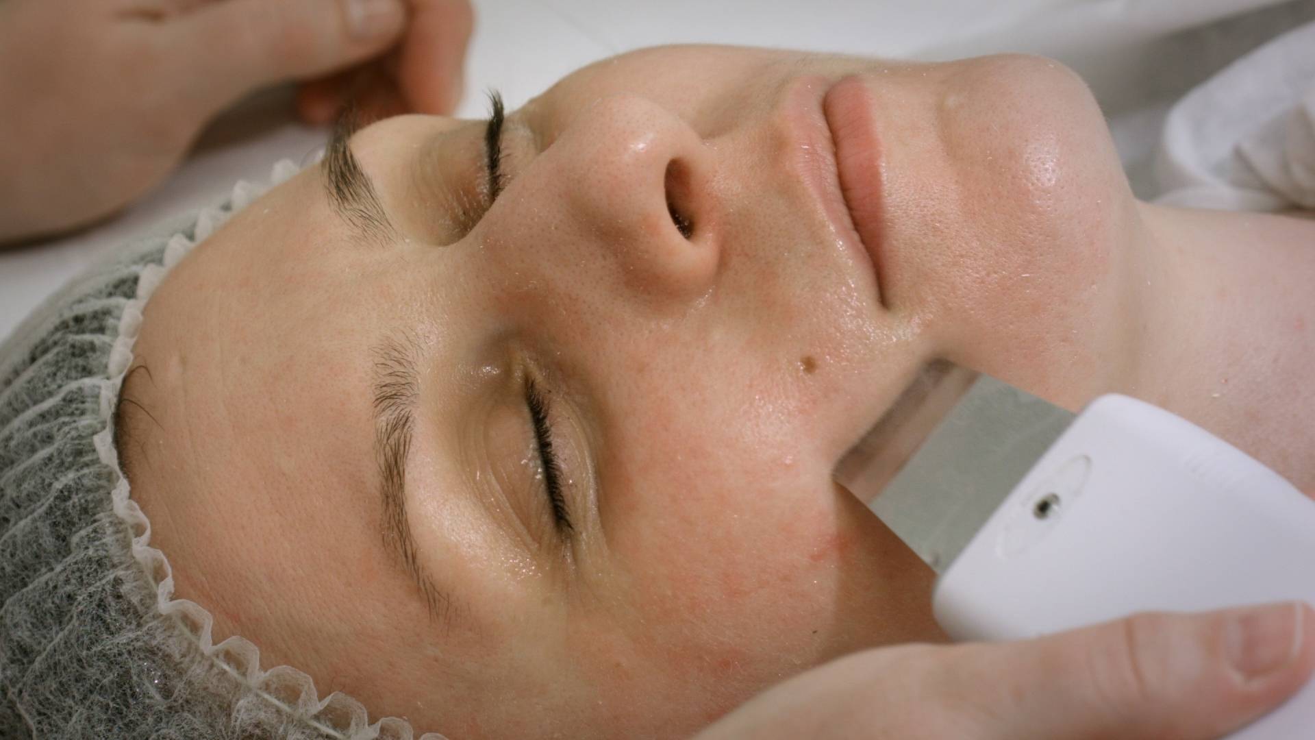 Гальваническая чистка лица – безболезненный метод - cosmetism