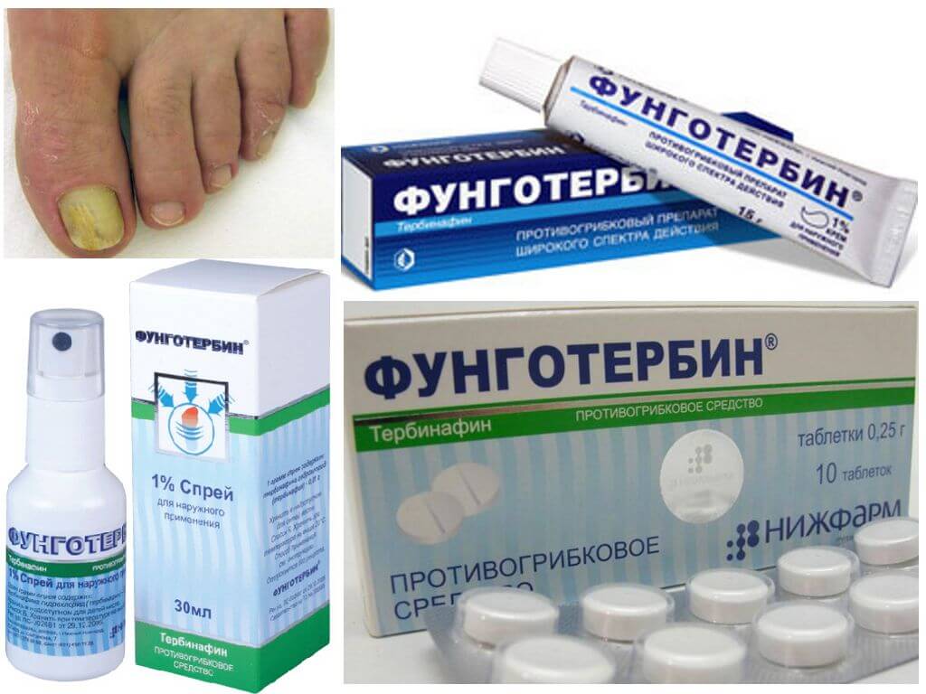 Все про мазь от грибка ногтей тербинафин: инструкция по применению, аналоги, противопоказания, отзывы | moninomama.ru