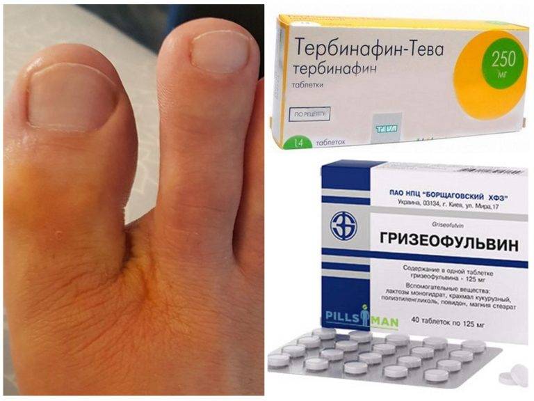 Тербинафин от грибка ногтей – отзывы, цена, инструкция по применению, аналоги