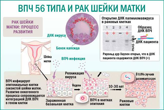 Лечение впч у женщин: можно ли вылечить навсегда, как и чем лечить папилломавирус - препараты и народные средства от вируса папилломы человека