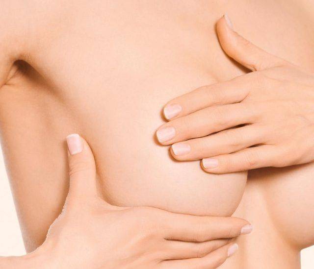 Папилломы под грудью у женщины: плоские наросты под грудными железами