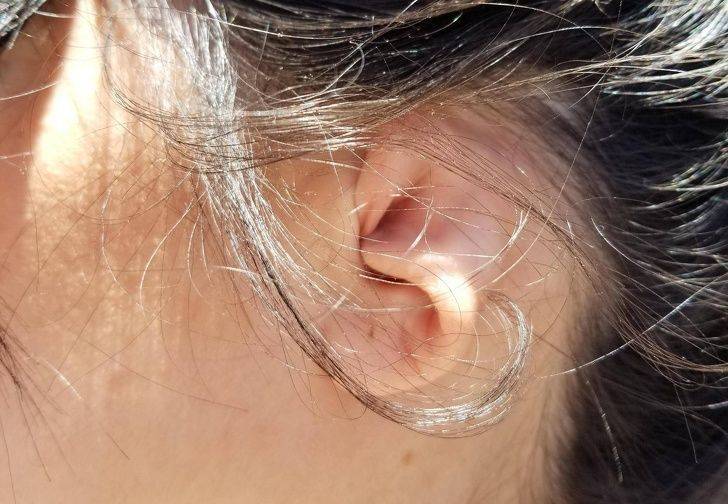 Перхоть в ушах: причины появления, способы лечения и профилактика рецидивов