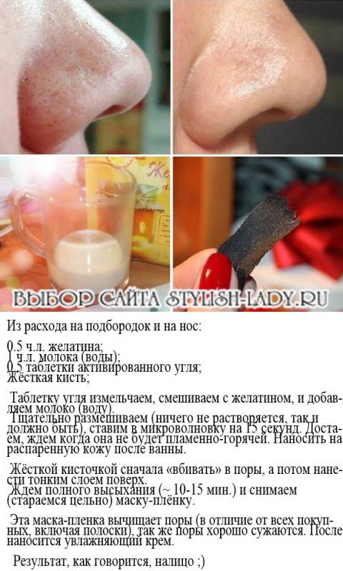 Сода от пигментных пятен - рецепты масок и компрессов для кожи