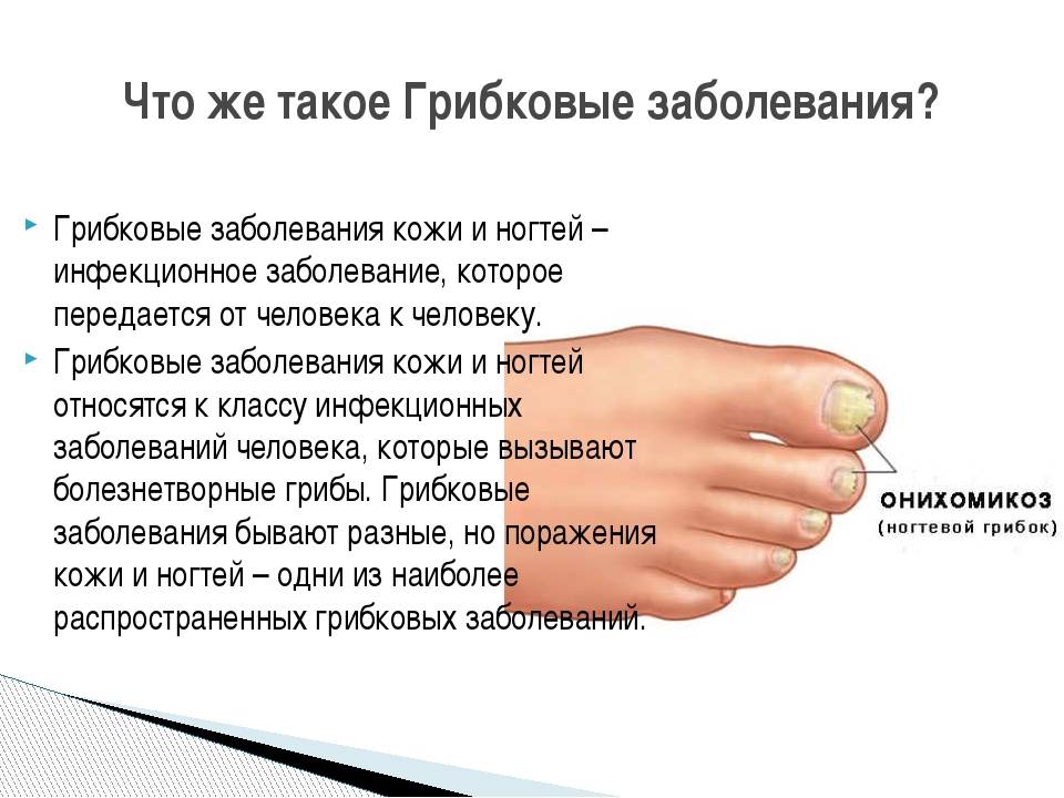 Диагностируем болезни по ногтям: 12 явных признаков