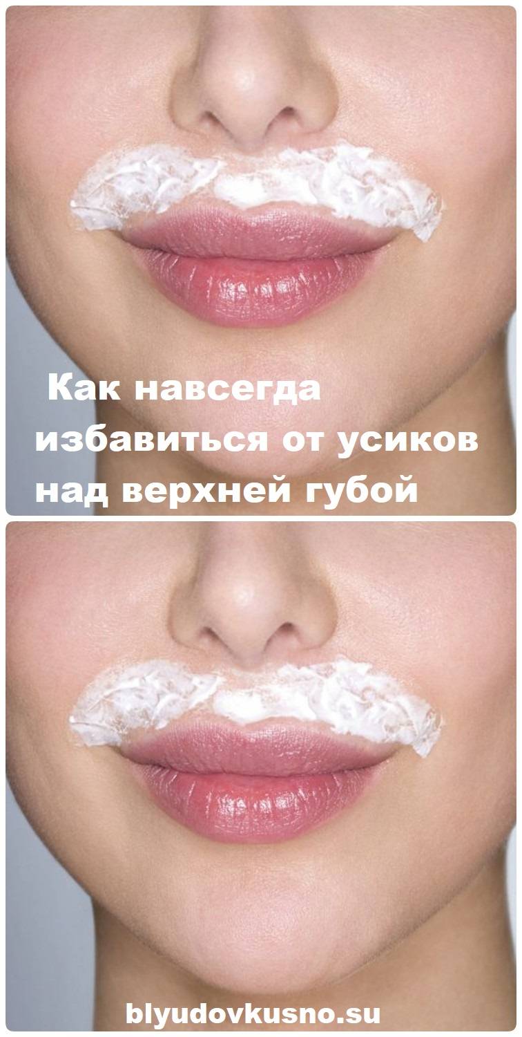 Как избавиться от усиков у женщин над верхней губой навсегда: 6 способов эпиляции усов в домашних условиях | qulady