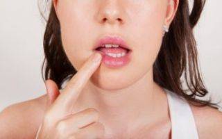 Мази, кремы и гели от герпеса на губах: список эффективных лекарств против герпеса