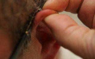 Герпес на ушах: причины появления и методы лечения