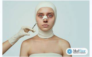 Как проводится инъекционная ринопластика носа?