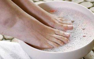 Лечим грибок ногтей чистотелом: обоснование и правильные рецепты