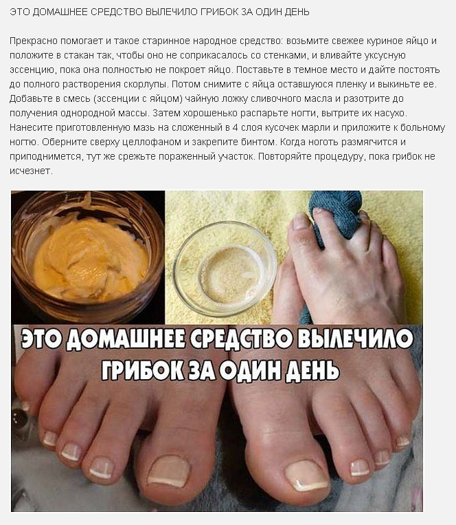 Лучшие народные средства от грибка на руках: как быстро избавиться от инфекции на коже, ногтях и между пальцами