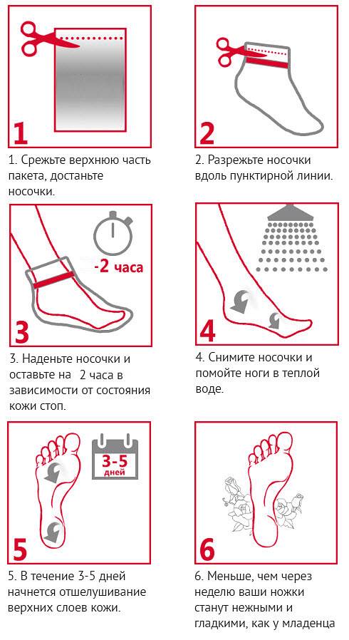 Как пользоваться носочками для ног