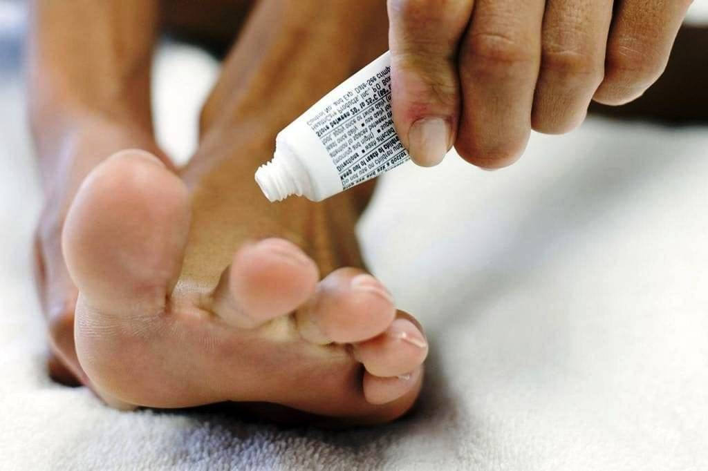 Лекарство от грибка на ногах: список эффективных препаратов для лечения микозов стоп и ногтей