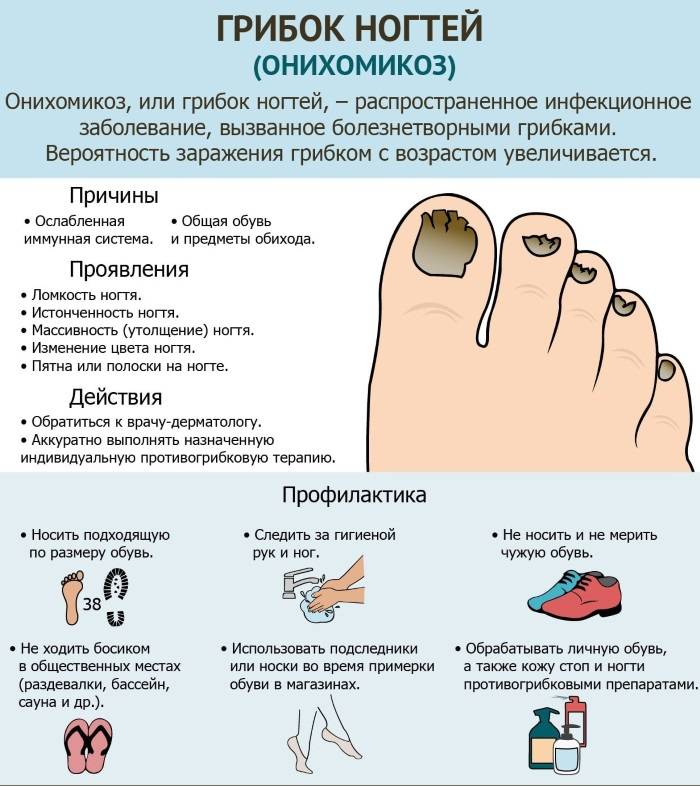 Экзема на пальцах ног - симптомы, диагностика и лечение разных форм заболевания