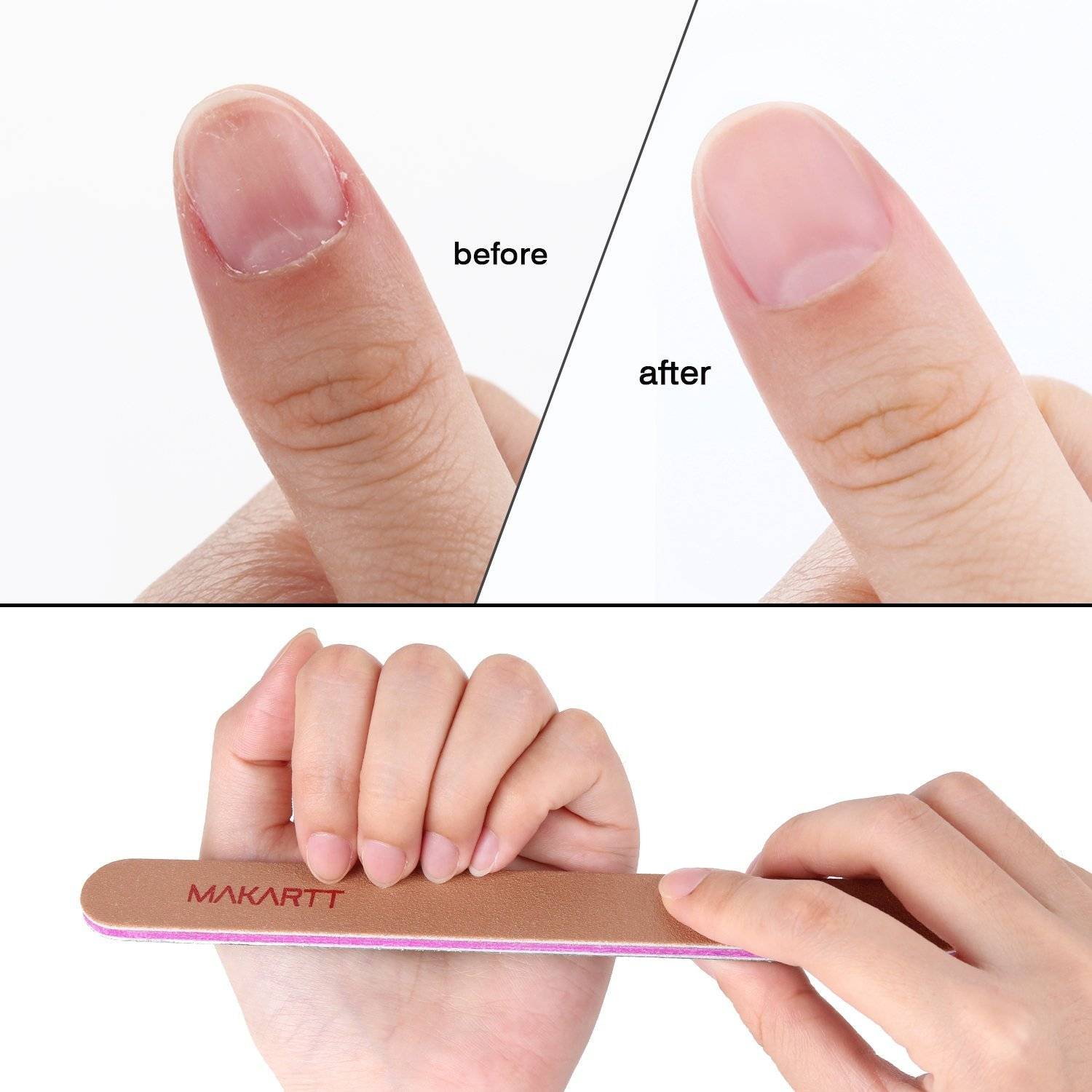 Как правильно пилить ногти на руках в домашних условиях. как правильно подпиливать ногти, чтобы они были красивыми и здоровыми