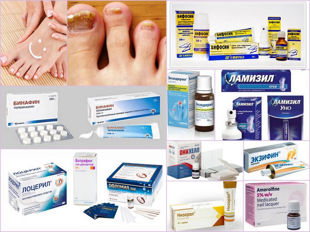 Лучшие недорогие и эффективные средства от грибка ногтей на ногах