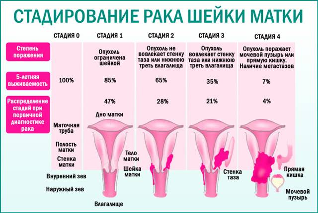 Вирус папилломы человека (впч) у женщин в гинекологии: симптомы, признаки, диагностика  и лечение папилломавируса