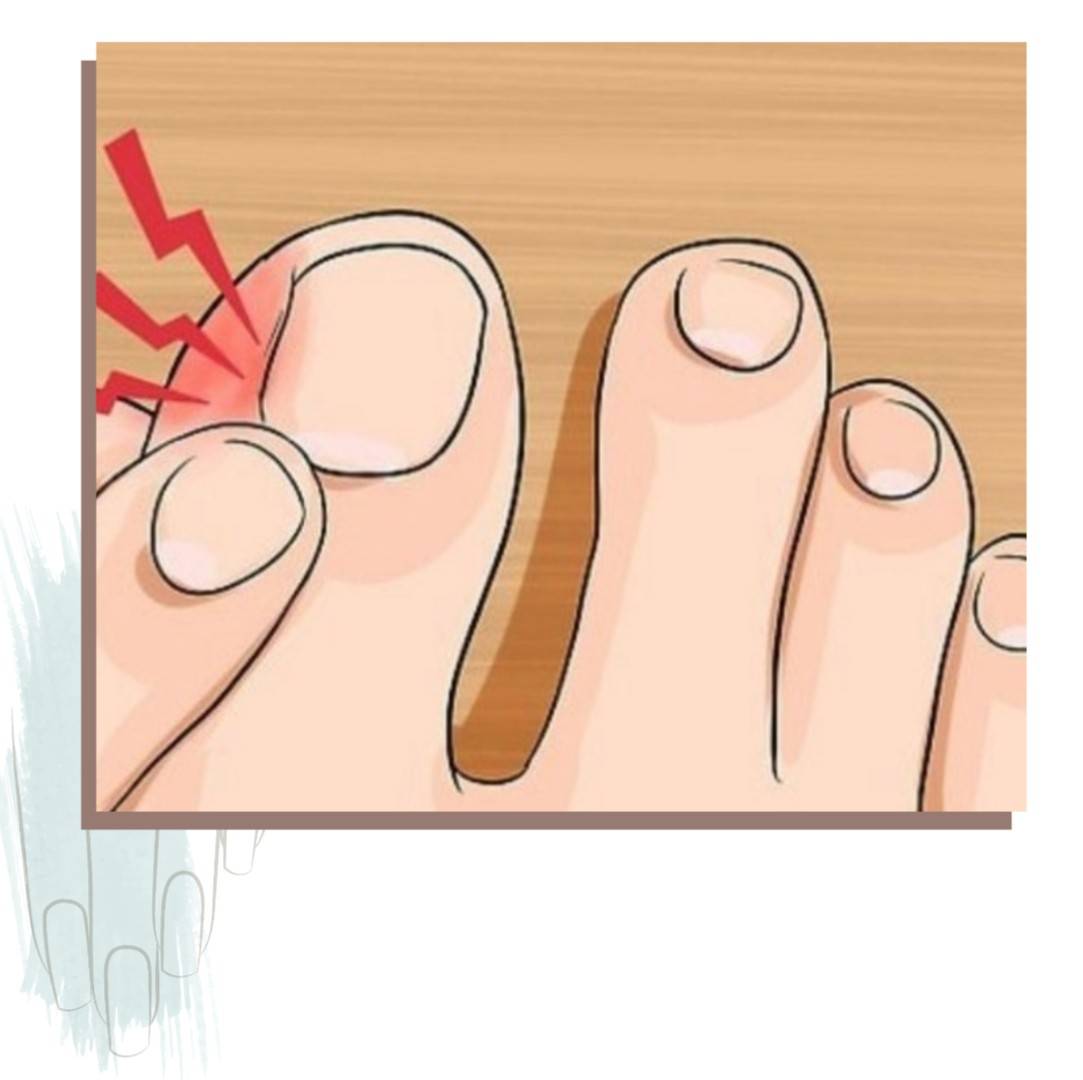 Как правильно стричь ногти на ногах?
