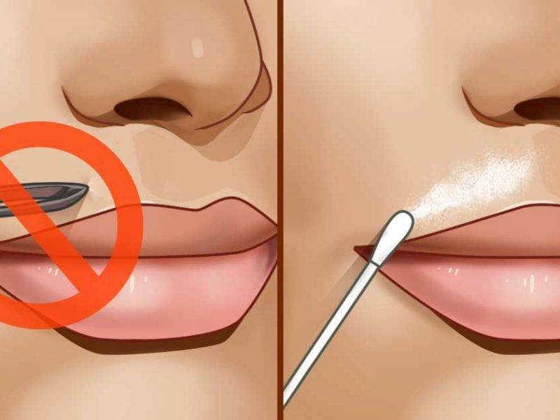 Как удалить усики над верхней губой? обзор методов депиляции и эпиляции
