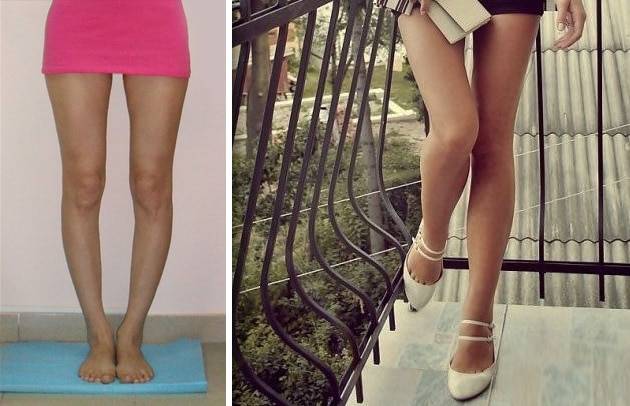Тонкие ляшки. Худые женские ноги. Красивая форма ног.