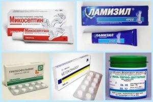 Лекарство от стригущего лишая: таблетки, антибиотик для лечения трихофитии у человека