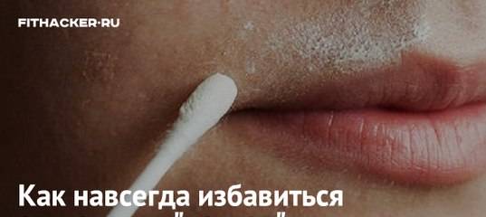 Как убрать усы у девушки в домашних условиях быстро