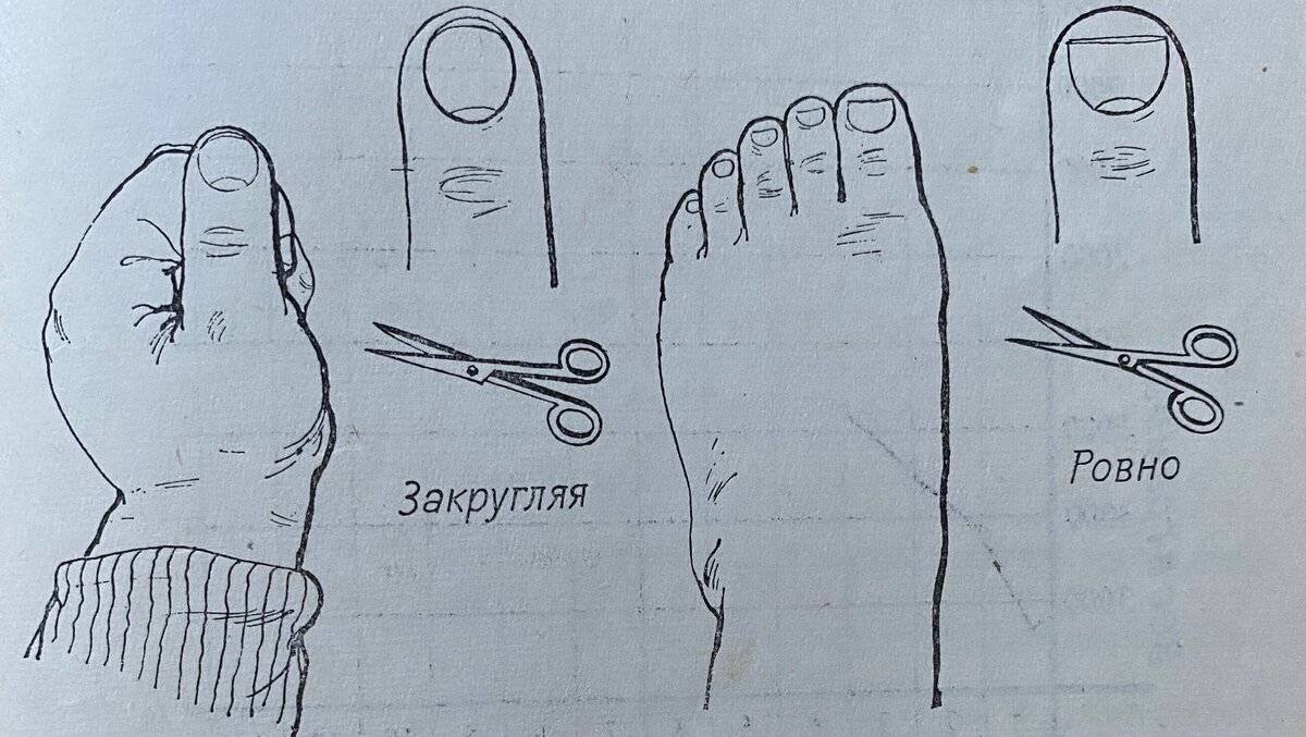 Как правильно стричь ногти на руках и на ногах? как правильно стричь вросший ноготь? как стричь ногти новорожденному?