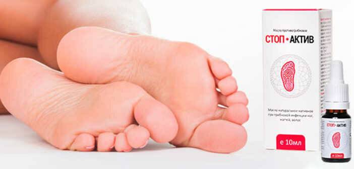 Грибок на ногах - симптомы, причины и методы лечения