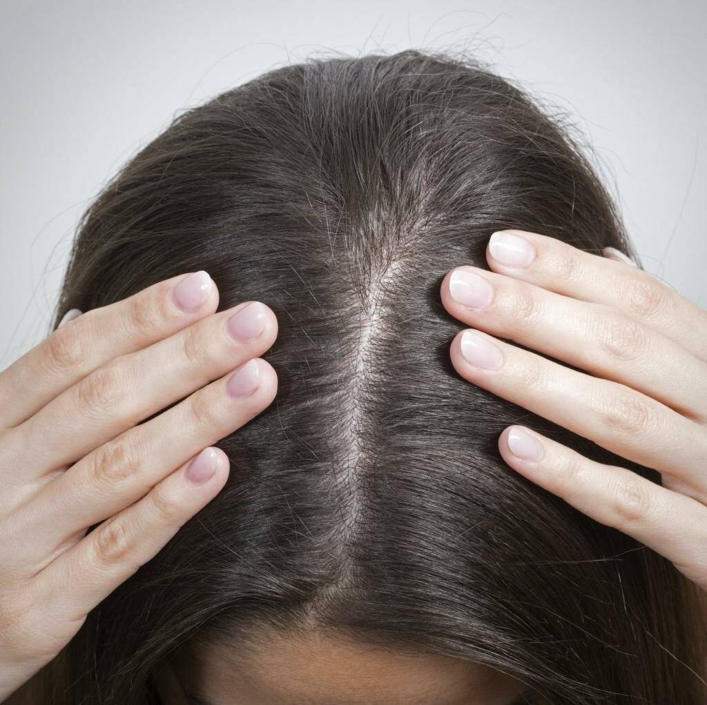 Психосоматика выпадения волос: влияние психического состояния на здоровье волос